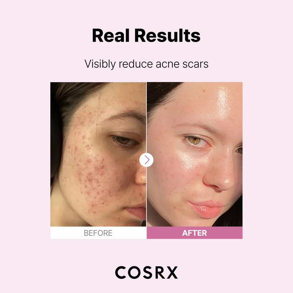 COSRX The Niacinamide 15 Serum 20ml