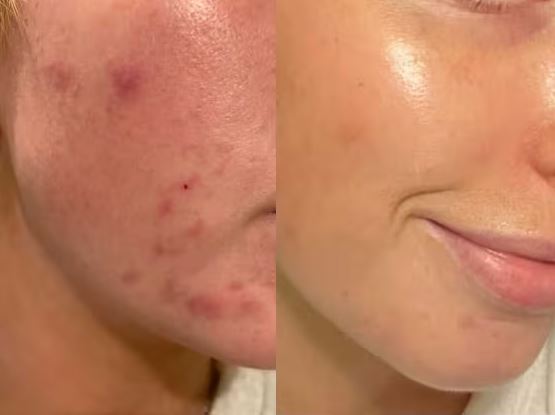 Paula's Choice Exfoliate Skin Perfecting 2% BHA Liquid Face Toner