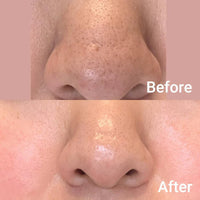 Medicube Zero Pore Pad 2.0 155g
