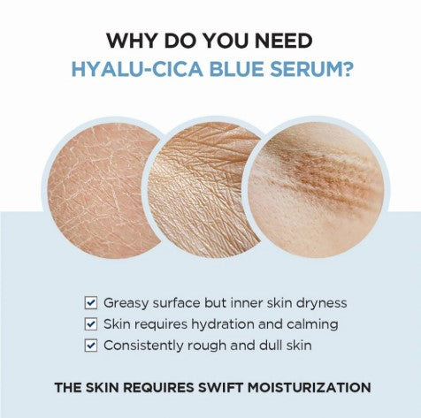 Skin1004 - Madagascar Centella Hyalu-Cica Blue Serum 50ml