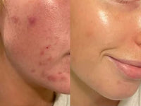 Paula's Choice Exfoliate Skin Perfecting 2% BHA Liquid Face Toner